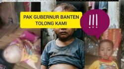 MIRIS! ANAK 3 TAHUN DENGAN PERUT MEMBESAR BUTUH PENGOBATAN, DIMANA PERAN PEMPROV BANTEN?