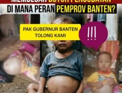 MIRIS! ANAK 3 TAHUN DENGAN PERUT MEMBESAR BUTUH PENGOBATAN, DIMANA PERAN PEMPROV BANTEN?